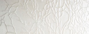 ERINDRINGENS OVERFLADE – Harpa Árnadóttir